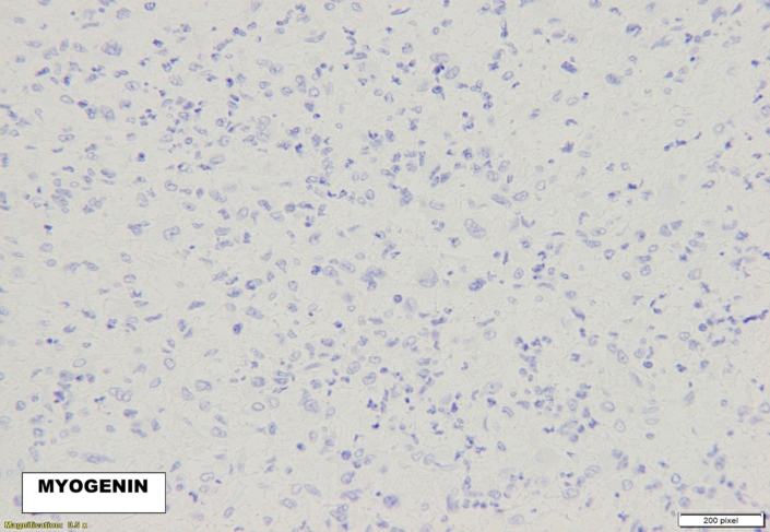 Myogenin