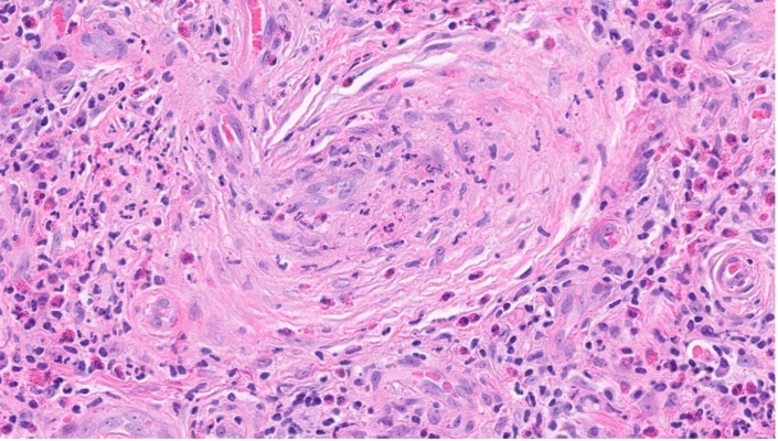 Fig1