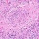 Fig1