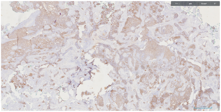 Fig5 p63