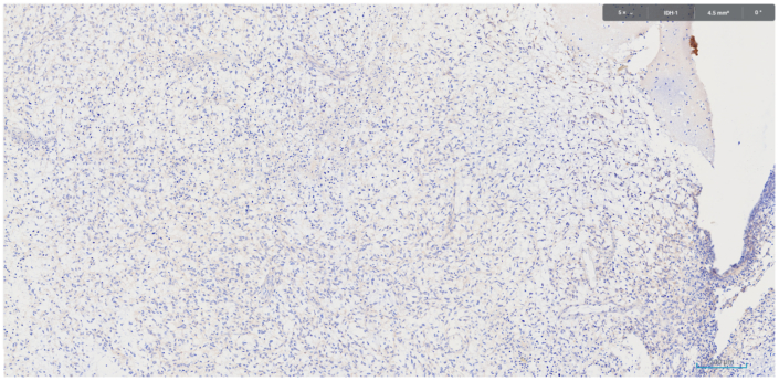 Fig 7 IDH