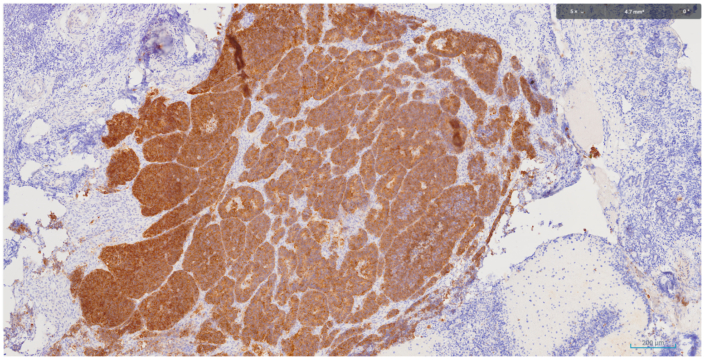 Fig5 Synaptophysin