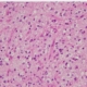 Fig2