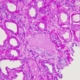 Fig4 PAS